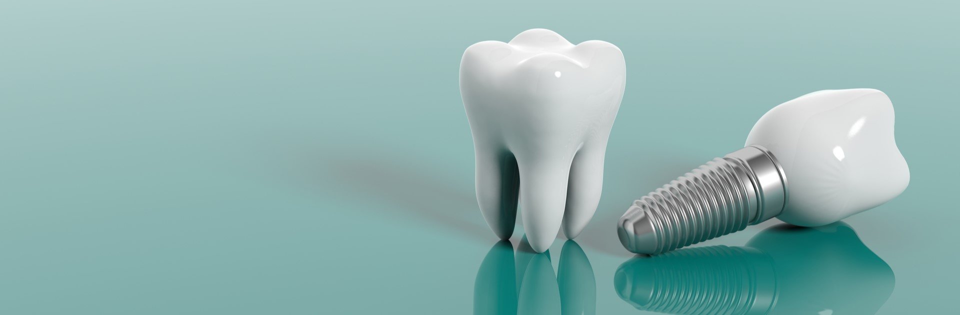 Diş İmplantı